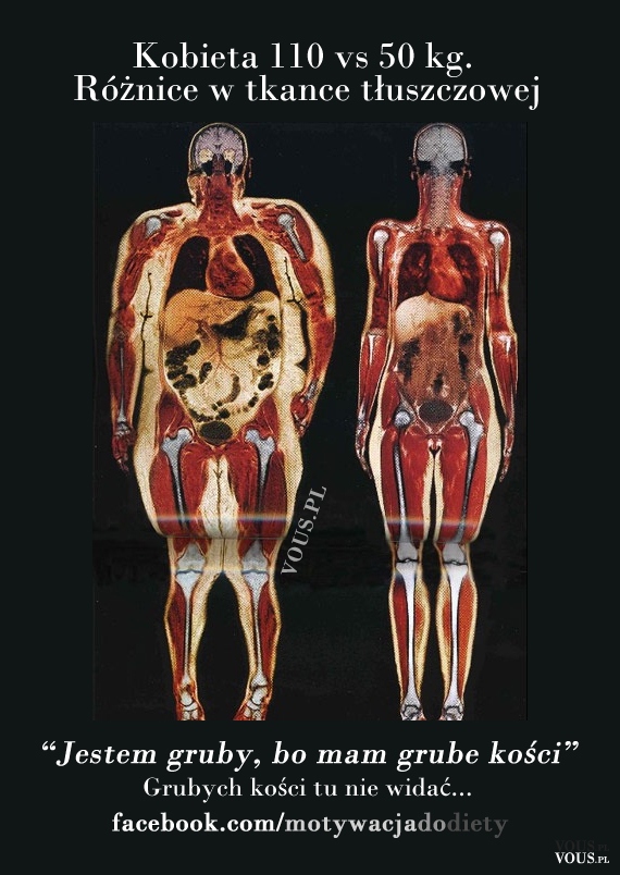 Kobieta 110 vs 50 kg. Różnice w tkance tłuszczowej – Grube kości. Czy istnieje coś takiego ...