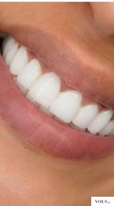 Idealne zęby